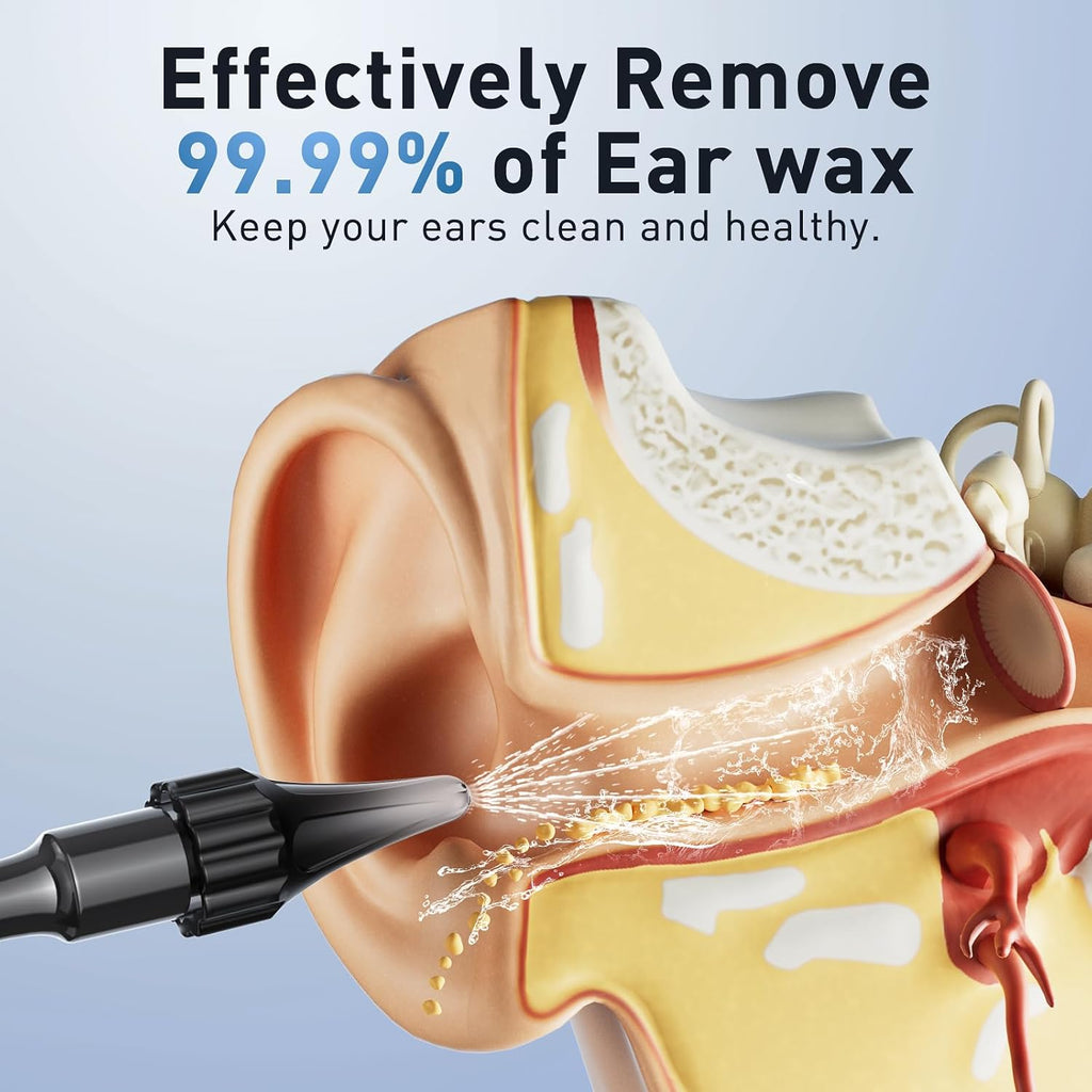 Ear Wax Removal - Electric Ear Irrigation Flushing System with 4 Pressure Modes, Ear Cleaner with Camera, 1080P Otoscope, Ear Cleaning Tool with 7 Pcs Ear Set, Safe and Effective Earwax Removal Kit