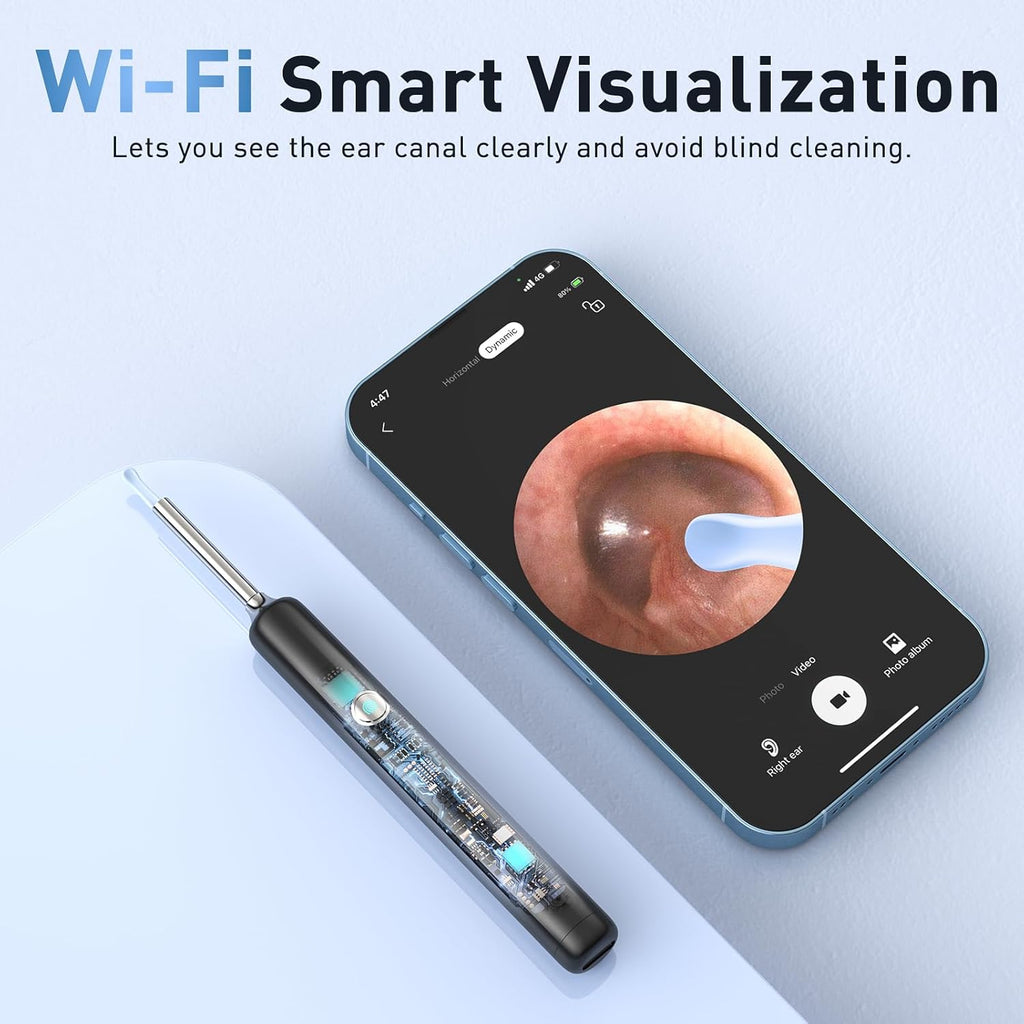 Ear Wax Removal - Electric Ear Irrigation Flushing System with 4 Pressure Modes, Ear Cleaner with Camera, 1080P Otoscope, Ear Cleaning Tool with 7 Pcs Ear Set, Safe and Effective Earwax Removal Kit