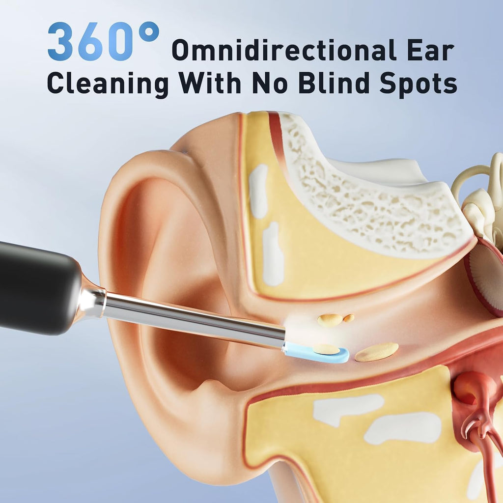 Ear Wax Removal - Electric Ear Irrigation Flushing System with 4 Pressure Modes, Ear Cleaner with Camera, 1080P Otoscope, Ear Cleaning Tool with 7 Pcs Ear Set, Safe and Effective Earwax Removal Kit